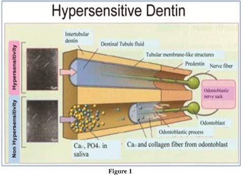 peroxide dentin diagram